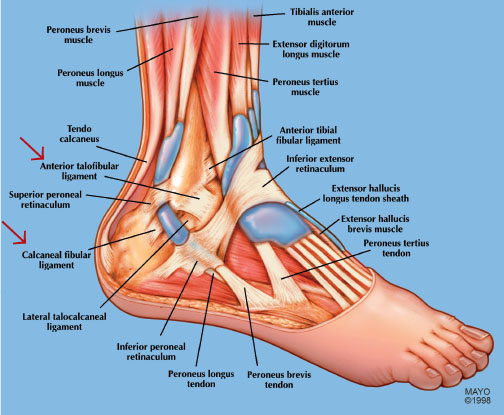 Rehabilitation of Syndesmotic (High) Ankle Sprains